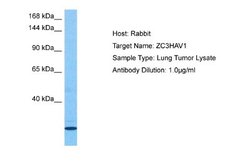 ZCCHV Antibody, Novus Biologicals 100 &mu;L; Unconjugated:Antibodies, Polyclonal